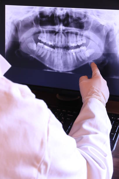 Best Emergency Wisdom Tooth Extraction in Gridley, IL