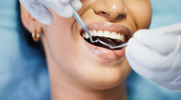 Best Lost Filling or Crown Replacement in Gridley, IL