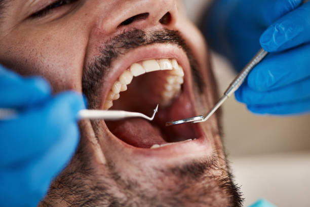 Best Emergency Dental Care for Sports Injuries in Gridley, IL